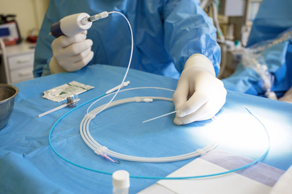 Navigating Coronary Stent Placement: A Comprehensive Overview